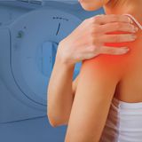 Rezonans magnetyczny splotu ramiennego