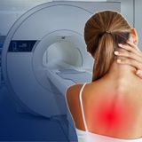 Rezonans magnetyczny kręgosłupa piersiowego bez kontrastu