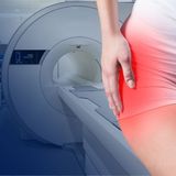 Sacroiliac joint MRI